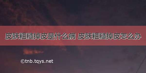 皮肤粗糙掉皮是什么病 皮肤粗糙掉皮怎么办