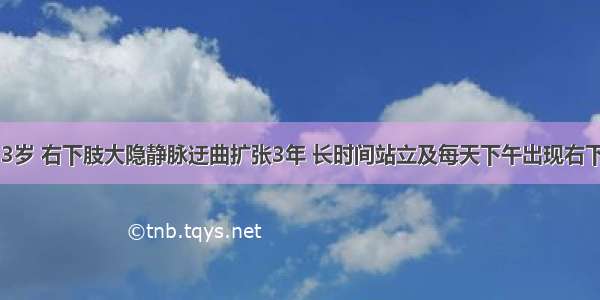 患者 女 33岁 右下肢大隐静脉迂曲扩张3年 长时间站立及每天下午出现右下肢肿胀伴