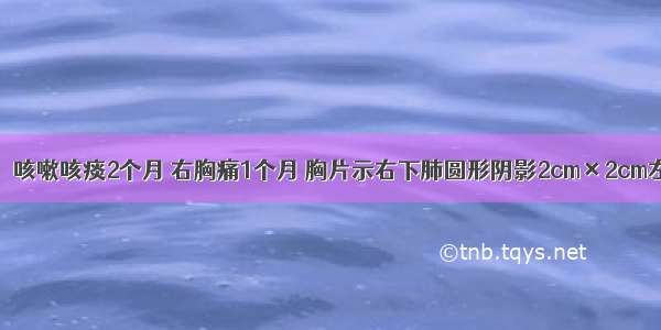 女性 50岁。咳嗽咳痰2个月 右胸痛1个月 胸片示右下肺圆形阴影2cm×2cm左右 肋骨有