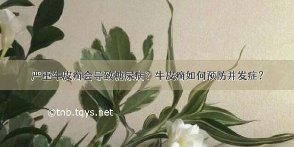 严重牛皮癣会导致糖尿病？牛皮癣如何预防并发症？