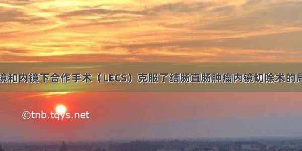 腹腔镜和内镜下合作手术（LECS）克服了结肠直肠肿瘤内镜切除术的局限性