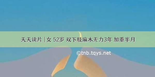 天天读片 | 女 52岁 双下肢麻木无力3年 加重半月