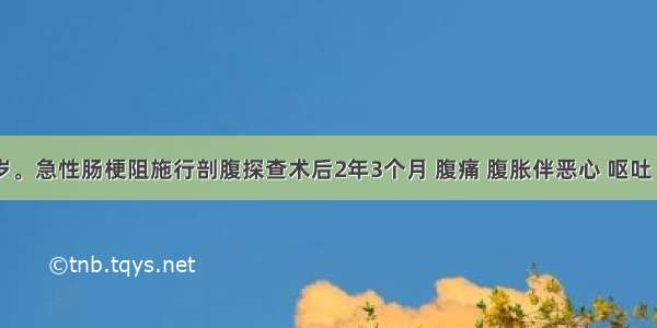 男性 33岁。急性肠梗阻施行剖腹探查术后2年3个月 腹痛 腹胀伴恶心 呕吐 无肛门排