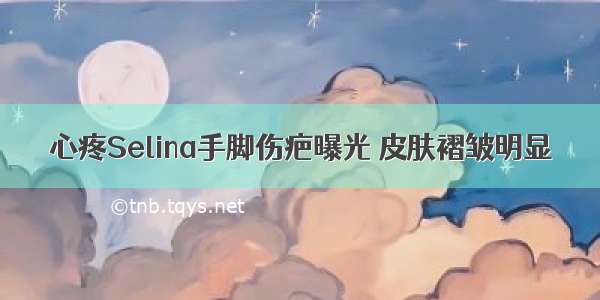 心疼Selina手脚伤疤曝光 皮肤褶皱明显