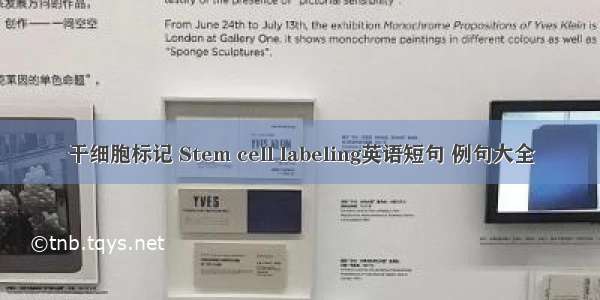 干细胞标记 Stem cell labeling英语短句 例句大全