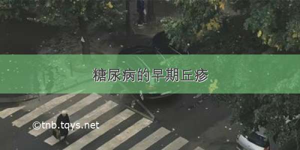 糖尿病的早期丘疹