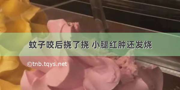 蚊子咬后挠了挠 小腿红肿还发烧