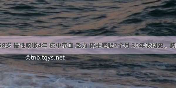 患者男 58岁 慢性咳嗽4年 痰中带血 乏力 体重减轻2个月 30年吸烟史。胸部X线片