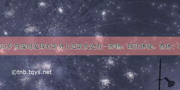 患者 女性 65岁 洗澡时发现右乳外上近乳头处有一肿物。既往体健。查体：右乳外上迂