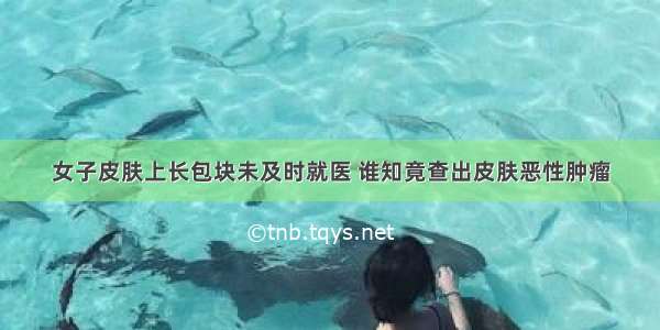 女子皮肤上长包块未及时就医 谁知竟查出皮肤恶性肿瘤