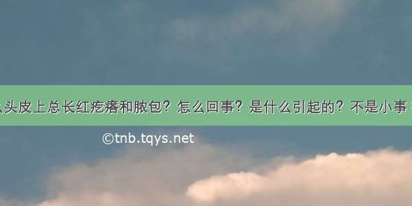 为什么头皮上总长红疙瘩和脓包？怎么回事？是什么引起的？不是小事 得当心