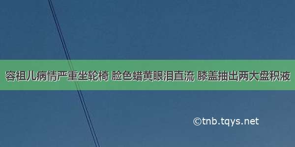 容祖儿病情严重坐轮椅 脸色蜡黄眼泪直流 膝盖抽出两大盘积液