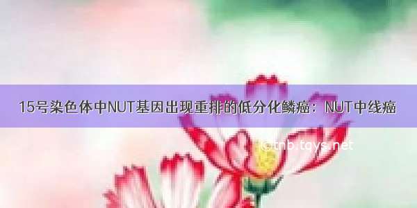 15号染色体中NUT基因出现重排的低分化鳞癌：NUT中线癌