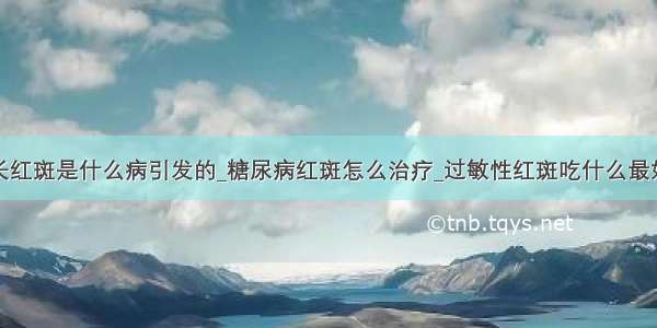 长红斑是什么病引发的_糖尿病红斑怎么治疗_过敏性红斑吃什么最好