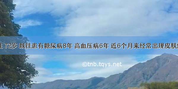 患者 男性 72岁 既往患有糖尿病8年 高血压病6年 近6个月来经常出现皮肤烧灼感及