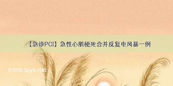 【急诊PCI】急性心肌梗死合并反复电风暴一例