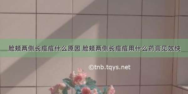 脸颊两侧长痘痘什么原因 脸颊两侧长痘痘用什么药膏见效快