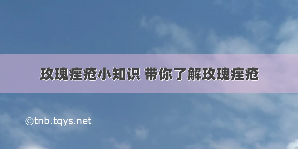 玫瑰痤疮小知识 带你了解玫瑰痤疮