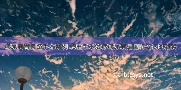 糖尿病胃旁路手术案例 减重手术治疗糖尿病是国际公认的趋势