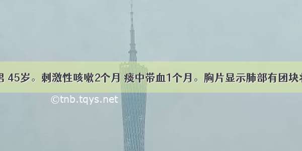 患者 男 45岁。刺激性咳嗽2个月 痰中带血1个月。胸片显示肺部有团块状阴影