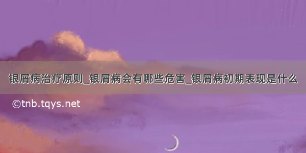 银屑病治疗原则_银屑病会有哪些危害_银屑病初期表现是什么