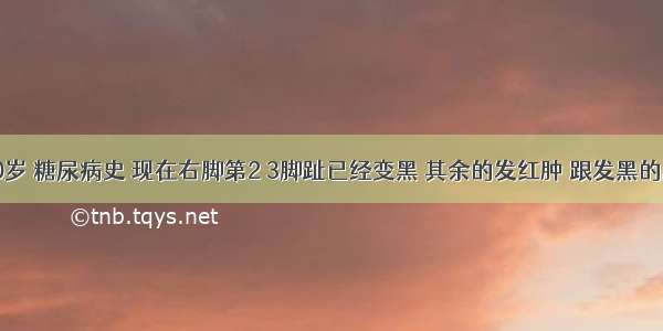 妈妈80岁 糖尿病史 现在右脚第2 3脚趾已经变黑 其余的发红肿 跟发黑的脚趾连