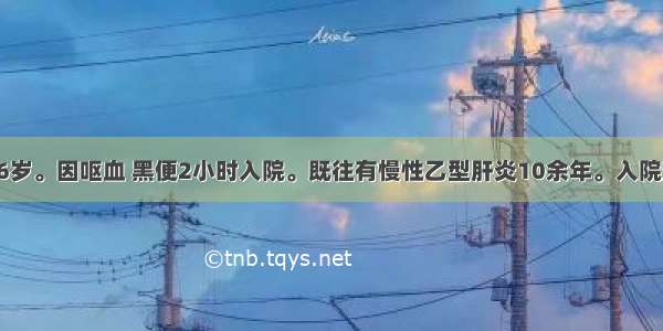 患者 男性 66岁。因呕血 黑便2小时入院。既往有慢性乙型肝炎10余年。入院查ALT124U