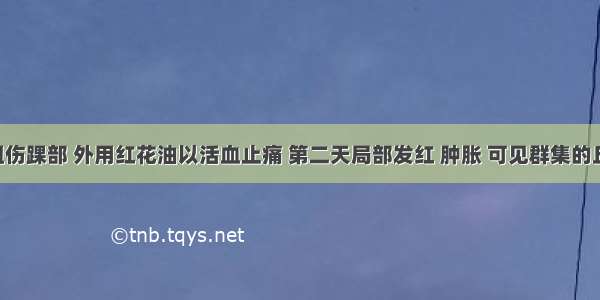 病人因扭伤踝部 外用红花油以活血止痛 第二天局部发红 肿胀 可见群集的丘疱疹 水