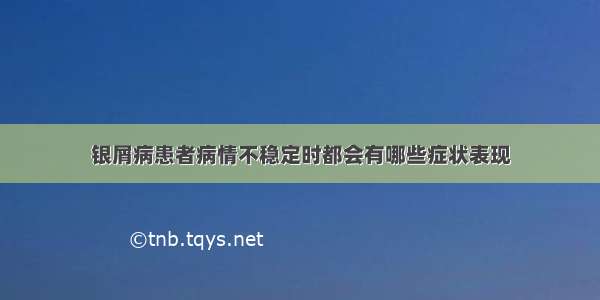 银屑病患者病情不稳定时都会有哪些症状表现