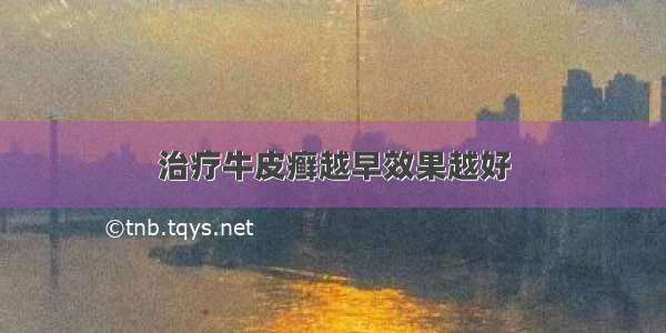 治疗牛皮癣越早效果越好