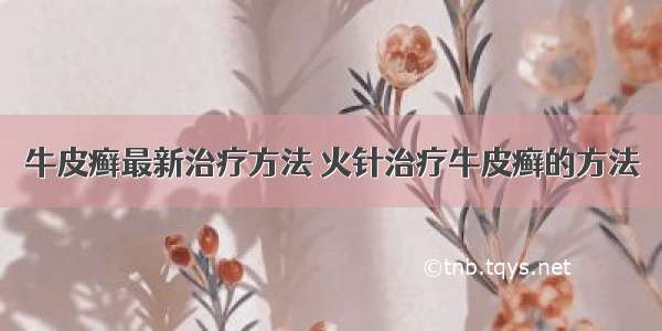 牛皮癣最新治疗方法 火针治疗牛皮癣的方法