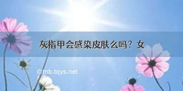 灰指甲会感染皮肤么吗？女