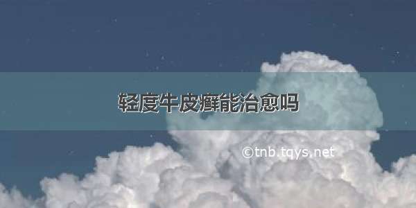 轻度牛皮癣能治愈吗