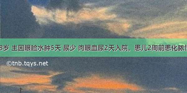 患儿男性 8岁 主因眼睑水肿5天 尿少 肉眼血尿2天入院。患儿2周前患化脓性扁桃体炎