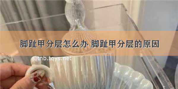 脚趾甲分层怎么办 脚趾甲分层的原因