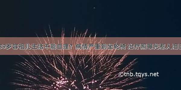 39岁容祖儿生活不能自理？病情严重到坐轮椅 治疗照曝光惹人泪目