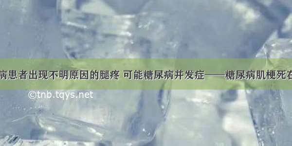 糖尿病患者出现不明原因的腿疼 可能糖尿病并发症——糖尿病肌梗死在作祟