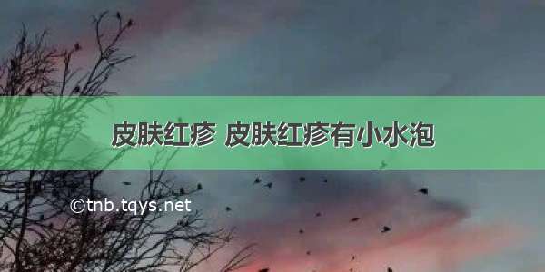 皮肤红疹 皮肤红疹有小水泡