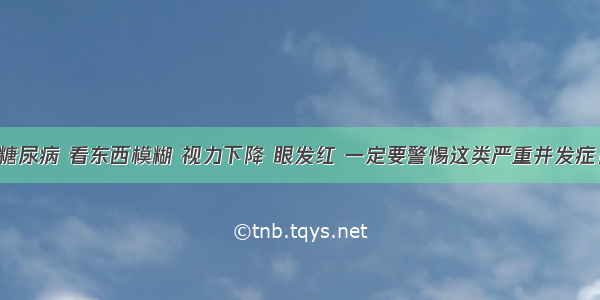 糖尿病 看东西模糊 视力下降 眼发红 一定要警惕这类严重并发症！