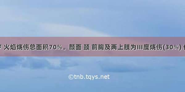 男性 30岁 火焰烧伤总面积70%。颜面 颈 前胸及两上肢为Ⅲ度烧伤(30%) 伤后1小时