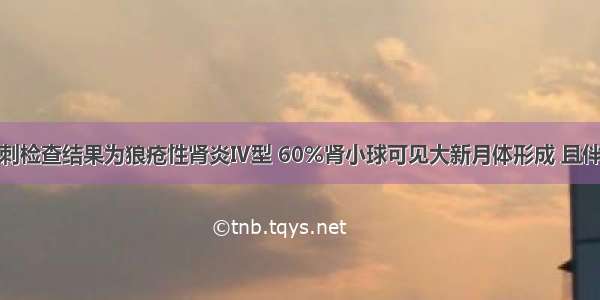 若患者肾穿刺检查结果为狼疮性肾炎Ⅳ型 60%肾小球可见大新月体形成 且伴有毛细血管