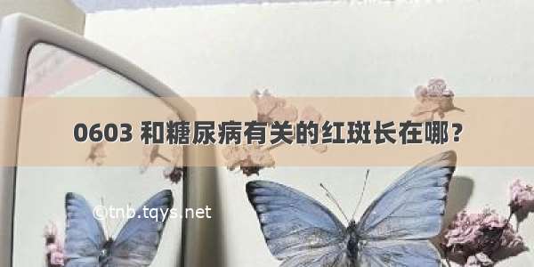 0603 和糖尿病有关的红斑长在哪？