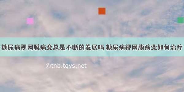 糖尿病视网膜病变总是不断的发展吗 糖尿病视网膜病变如何治疗